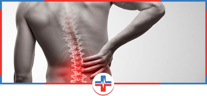 Back Sprains Treatment Questions and Answers
