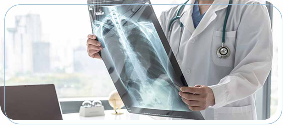 Where to Get an X-Ray Near Me in Long Beach and Paramount CA